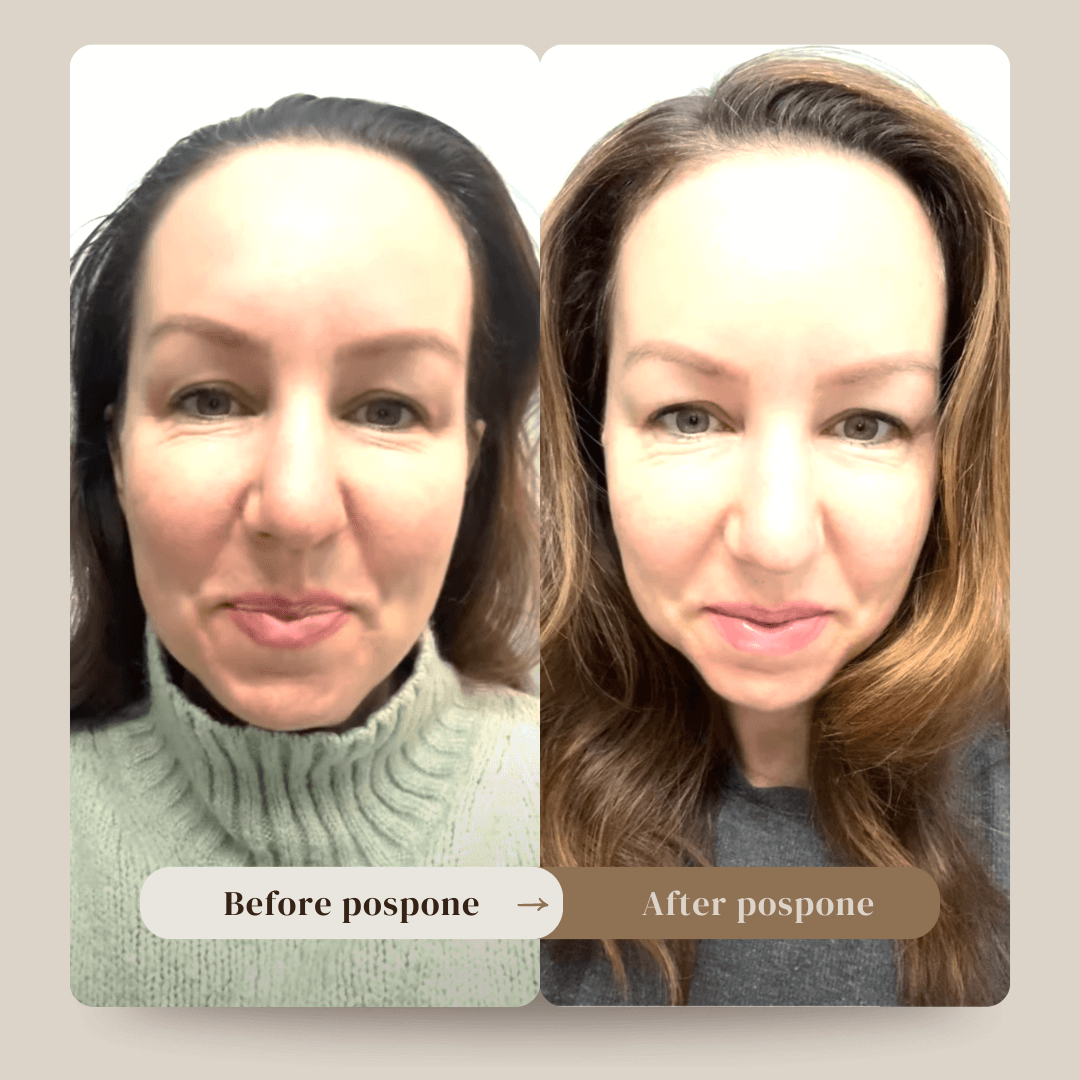 Woman’s hair transformation with pospone™ — from greasy and flat to refreshed, full of volume, and visibly healthier in just one use.